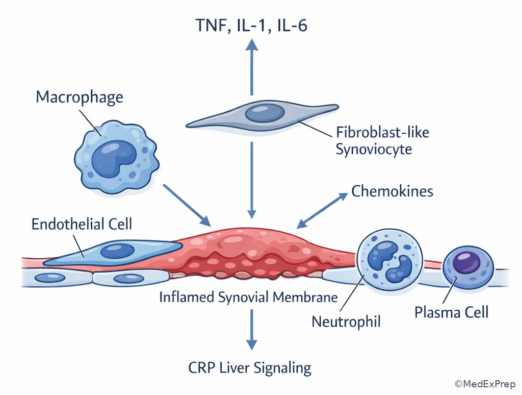 Labeled cytokine network in inflamed synovium
